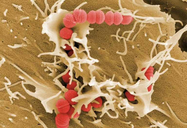 Στρεπτόκοκκος, το βακτήριο που ζει πάνω μας αλλά μπορεί να σκοτώσει
