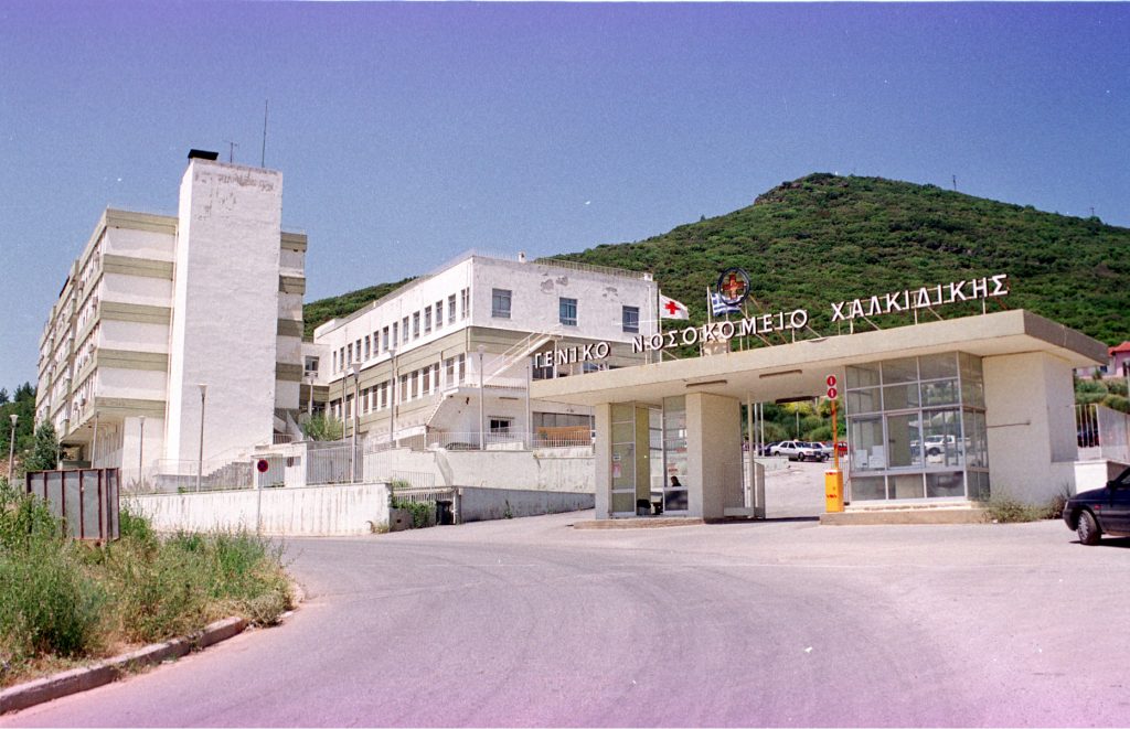 Χαλκιδική: Γιατροί φώναξαν… ηλεκτρολόγο να τροχίσει δαχτυλίδι που σφήνωσε σε δάχτυλο ασθενούς