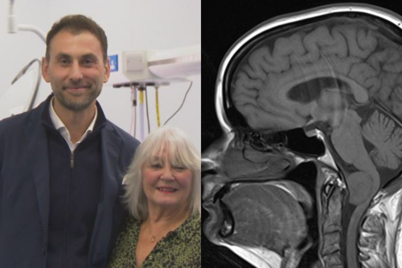 Ο Έλληνας νευροχειρουργός που αφαιρεί όγκους από τον εγκέφαλο μέσω των φρυδιών