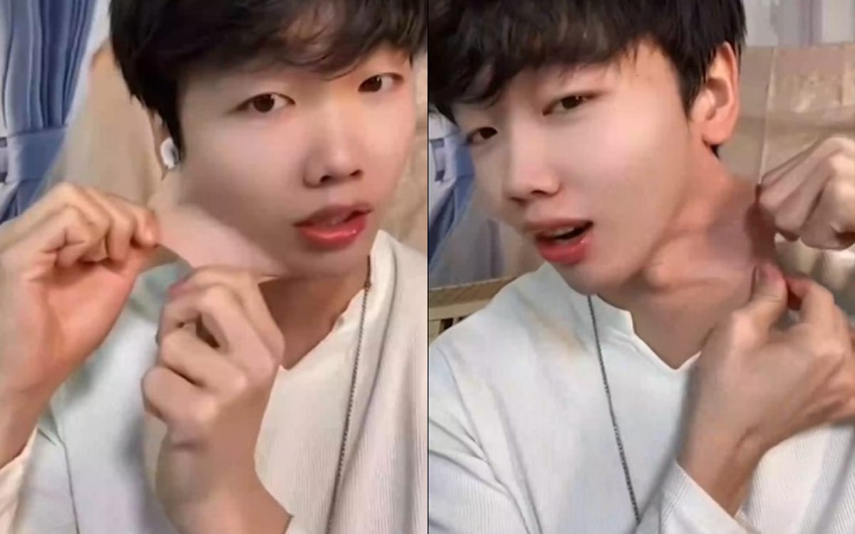 Είναι αυτός ο άνθρωπος με το πιο ελαστικό δέρμα στον κόσμο;