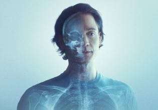 O Μπράιαν Τζόνσον, o πολυεκατομμυριούχος ενάντια στο θάνατο, θέλει να μην πεθάνεις