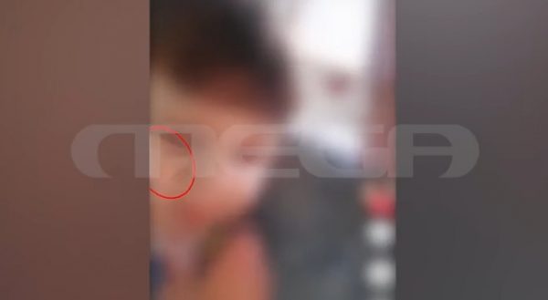 Κακοποίηση στο Ηράκλειο: Εσβηναν τσιγάρα στα γεννητικά όργανα του 3χρονου – Σοκάρει το πόρισμα του ιατροδικαστή