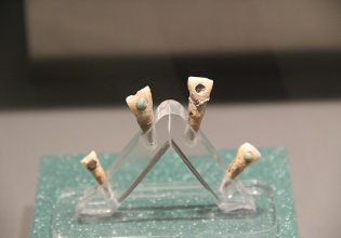 Γιατί οι Μάγια έβαζαν πολύτιμους λίθους στα δόντια τους; – Spoiler alert: Οι λόγοι δεν ήταν μόνο αισθητικοί