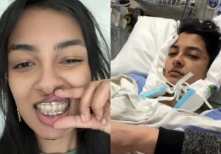 TikToker έσπασε το σαγόνι της τρώγοντας καραμέλα σε μέγεθος μπάλας του τένις