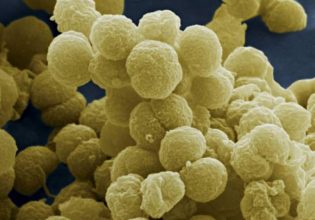 Μηνιγγίτιδα – Μαγιορκίνης: Σε επιφυλακή οι ειδικοί για την αύξηση κρουσμάτων – Το χαρακτηριστικό σύμπτωμα