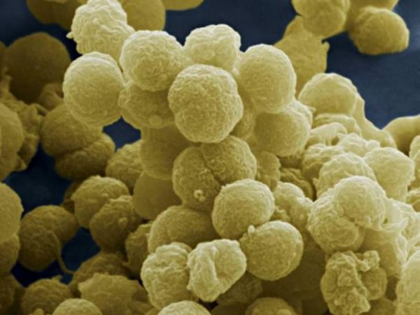 Μηνιγγίτιδα – Μαγιορκίνης: Σε επιφυλακή οι ειδικοί για την αύξηση κρουσμάτων – Το χαρακτηριστικό σύμπτωμα