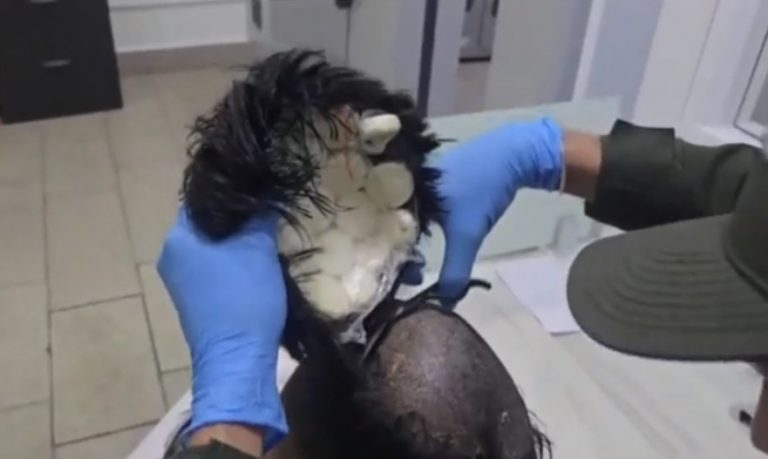 Κολομβία: Μετέφερε κοκαΐνη σε… περούκα και τον τσάκωσαν στο αεροδρόμιο