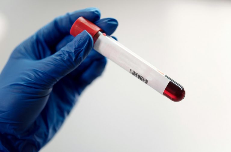 Τεστ αίματος ανιχνεύει τον καρκίνο του παγκρέατος πριν εξαπλωθεί