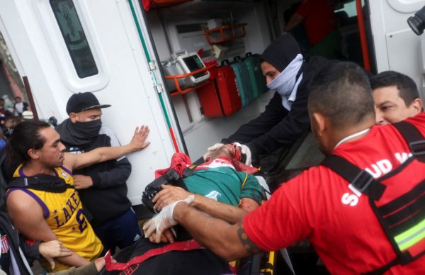 Μπουένος Άιρες: Η στιγμή που δακρυγόνο «βρίσκει» στο κεφάλι φωτορεπόρτερ – Βρίσκεται σε κώμα