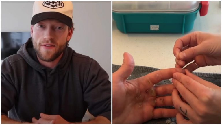 Έσπασε ρεκόρ Guinness σε μόλις μία μέρα, αλλά… τα αποτελέσματα ήταν ανατριχιαστικά