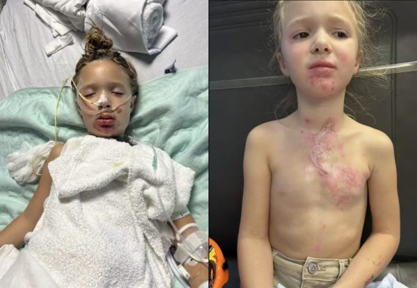 ΗΠΑ: Σε τεχνητό κώμα 7χρονη μετά από challenge στο TikTok