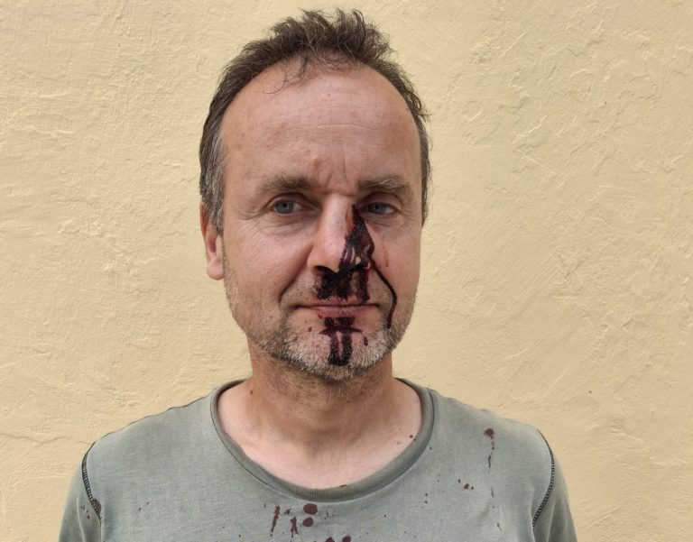 Ζάκυνθος – Καταγγελία: 15 λαθροθήρες επιτέθηκαν και τραυμάτισαν βαριά εθελοντές