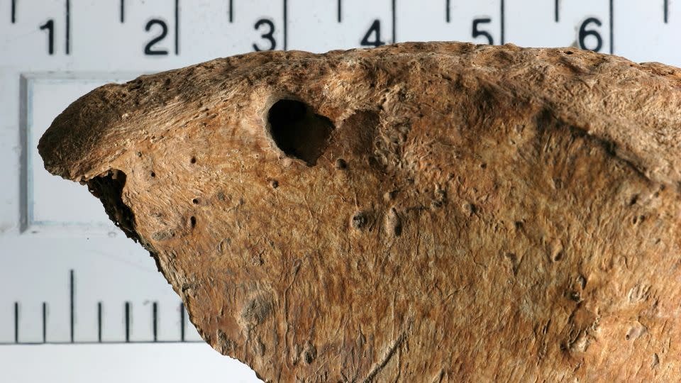 Τα τραύματα στο λαγόνιο οστό του άνδρα δεν παρουσιάζουν σημεία επούλωσης (T. J. U. Thompson et al. / PLoS ONE 2025)