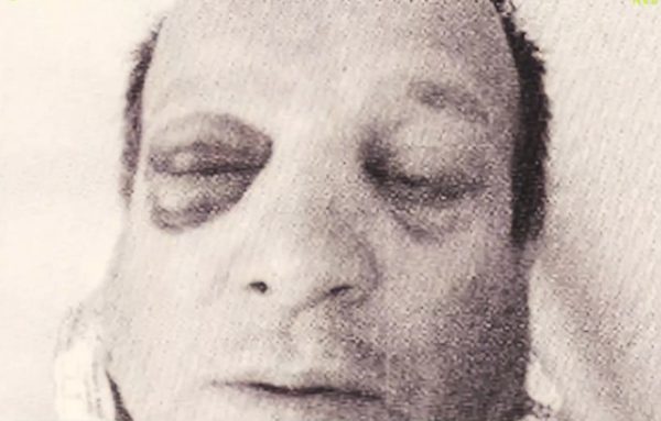 Αλεξανδρούπολη: «Με ξέχασαν όλοι» – Η εξομολόγηση του αστυνομικού μετά την επίθεση με τσεκούρι