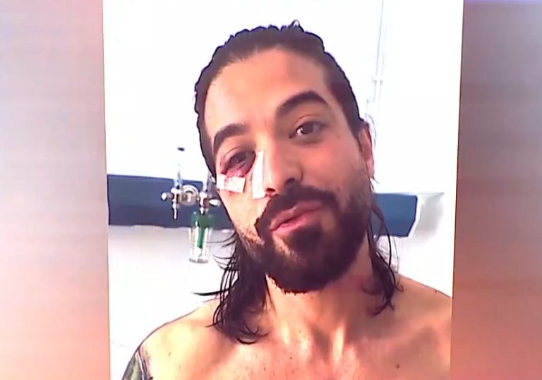 Η έκρηξη αφήνει τον Άρη Μουγκοπέτρο με βαριά βλάβη στο μάτι  – Τι λέει ο 36χρονος φίλος του