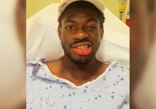 Lil Nas X: Στο νοσοκομείο ο ράπερ – Παρέλυσε η μία πλευρά του προσώπου του