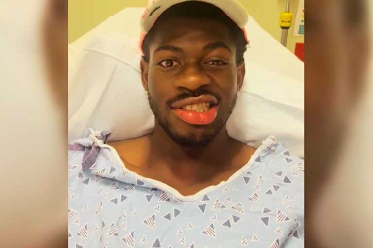 Lil Nas X: Στο νοσοκομείο ο ράπερ – Παρέλυσε η μία πλευρά του προσώπου του