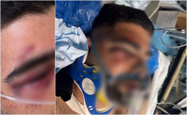 «Ο γιος μου ζει από τύχη» – Νέα καταγγελία για αστυνομική βία εναντίον 20χρονου