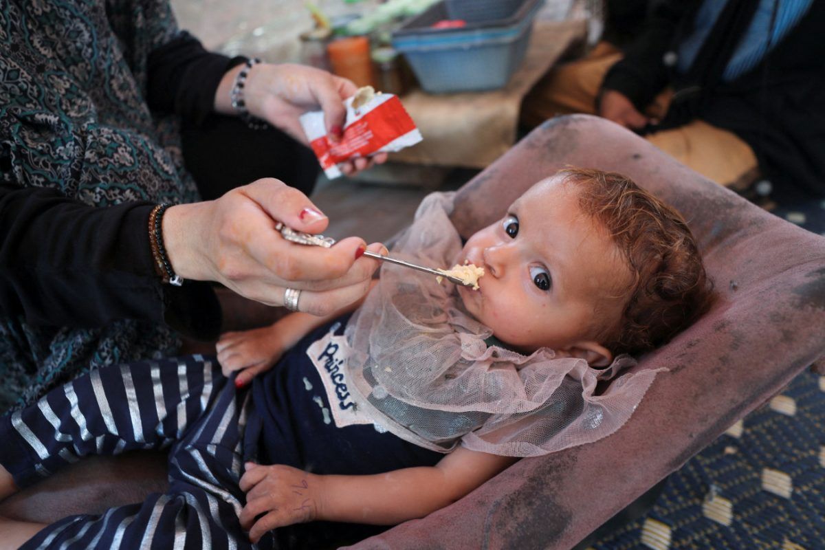 Γάζα: Άλλο ένα τετράχρονο αγόρι πέθανε από ασιτία – 70.000 παιδιά σε κίνδυνο λόγω της πείνας