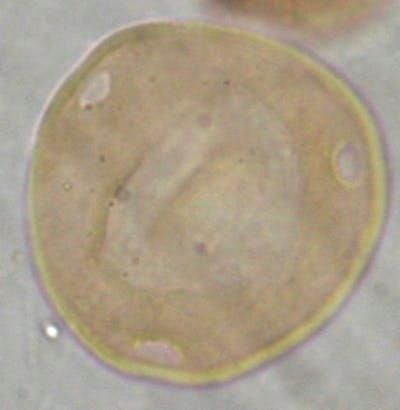 Απολιθωμένοι γυρεόκοκκοι του φυτού κάρυα, ηλικίας εκατομμυρίων ετών, βρέιθηκαν στο νοτιοανατολικό Μιζιούριο (Francisca Oboh Ikuenobe)