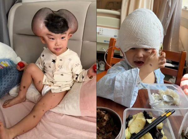 Συγκινεί η ιστορία του μικρού Qibao – Τον αποκαλούσαν «Μίκυ Μάους» λόγω σπάνιας πάθησης