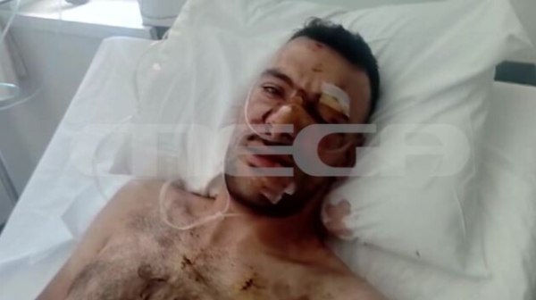 Πανηγύρι στη Μυτιλήνη: «Αποφασισμένος να σκοτώσει ο 32χρονος»