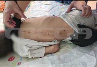 Θρίλερ με σημάδια στην πλάτη 7χρονου – Τι ερευνά η αστυνομία