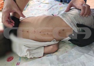 Πάτρα: Θρίλερ με το παιδί και τα σημάδια στην πλάτη – Παρέμβαση εισαγγελέα μετά τις αποκαλύψεις