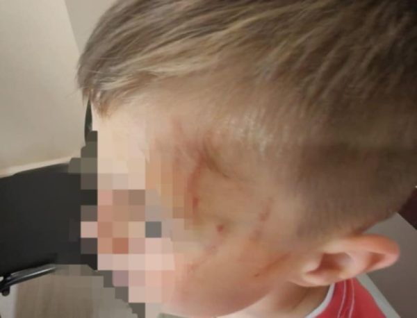 Αγρίνιο: Θύμα ξυλοδαρμού από συμμαθητές του έπεσε 5χρονος σε νηπιαγωγείο