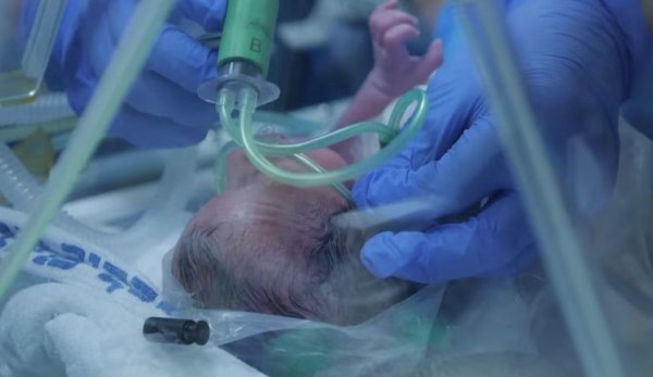 Ισραήλ: Μέσα στον φόβο γεννήθηκε η ελπίδα- Τρίδυμα ήρθαν στον κόσμο εν μέσω βομβαρδισμών