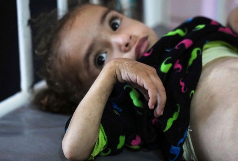 Τα καλοκαίρια μας μικρά λόγω ακρίβειας, εξοργιστικά λόγω κυβερνητικού εμπαιγμού, ζοφερά με σκελετωμένα παιδιά στη Γάζα λόγω ατίμωσης του ανθρωπίνου πολιτισμού