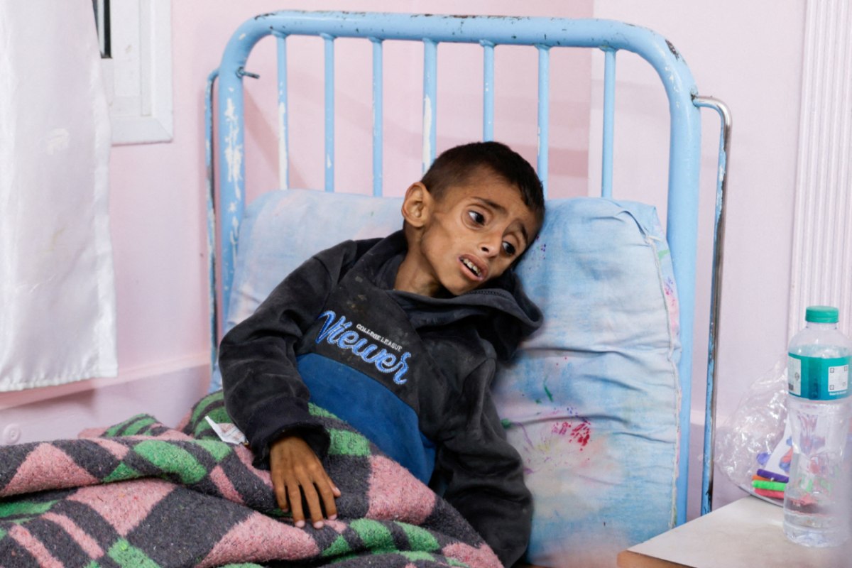 Γάζα: Τουλάχιστον 37 νεκροί από τα ξημερώματα της Τετάρτης – ΟΗΕ: 10 παιδιά ανά ημέρα χάνουν τα πόδια τους