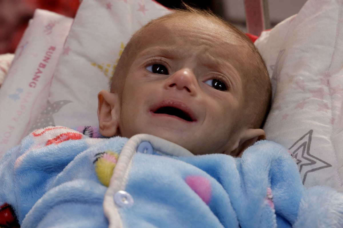 Γάζα: «Ό,τι έχει απομείνει είναι μόνο δέρμα και κόκκαλα» – Η αδυσώπητη πραγματικότητα για τα παιδιά