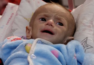 Γάζα: «Ό,τι έχει απομείνει είναι μόνο δέρμα και κόκκαλα» – Η αδυσώπητη πραγματικότητα για τα παιδιά