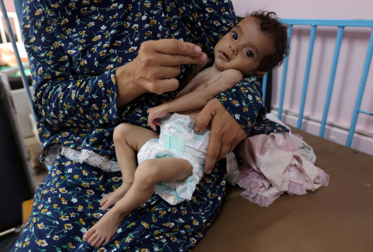 Γάζα: Το 1/4 των παιδιών που εξετάστηκαν από τους Γιατρούς Χωρίς Σύνορα αντιμετωπίζουν οξύ υποσιτισμό