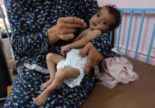 Γάζα: Το 1/4 των παιδιών που εξετάστηκαν από τους Γιατρούς Χωρίς Σύνορα αντιμετωπίζουν οξύ υποσιτισμό