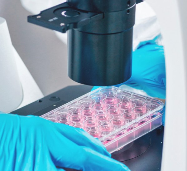 Χάνει έδαφος η Ευρώπη στην έρευνα – 10% κάτω οι κλινικές μελέτες