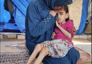 Γκουτέρες για τη Γάζα: Βλέπουμε εργαζομένους μας να πεθαίνουν σε ζωντανή σύνδεση από την πείνα