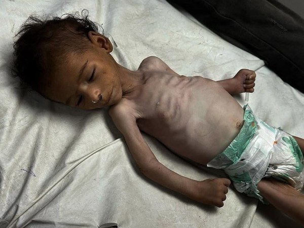 Γάζα: Οι Παλαιστίνιοι πεθαίνουν από την πείνα και οι ακροδεξιοί στο Ισραήλ προετοιμάζουν τη Ριβιέρα