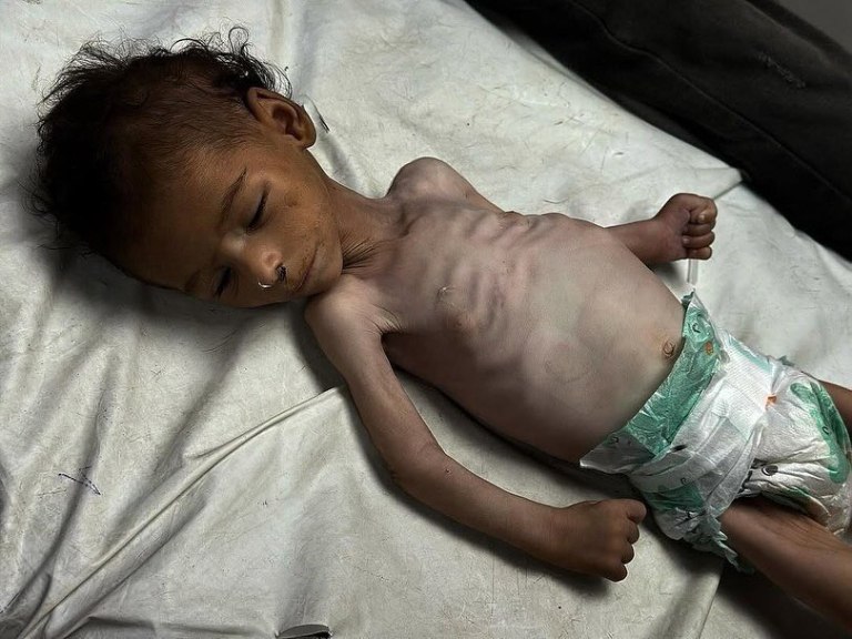 Γάζα: Οι Παλαιστίνιοι πεθαίνουν από την πείνα και οι ακροδεξιοί στο Ισραήλ προετοιμάζουν τη Ριβιέρα