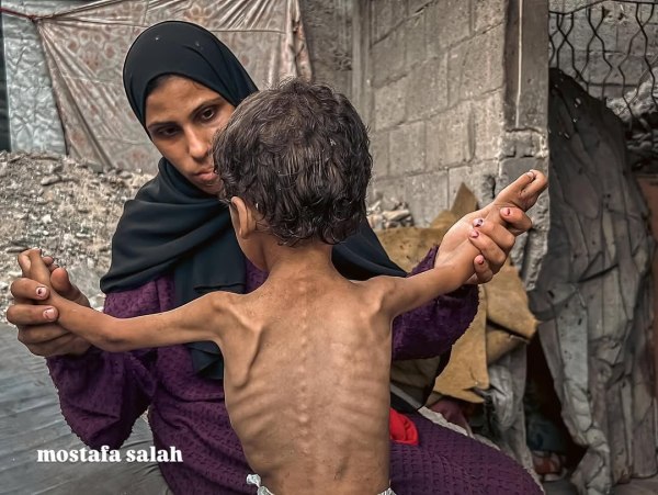 Γάζα: «Εφιάλτης ιστορικών διαστάσεων», λέει ο ΟΗΕ, κάνοντας έκκληση για άμεση κατάπαυση του πυρός