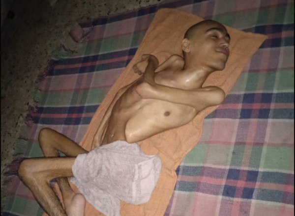 Γάζα: «Σαδιστική παγίδα θανάτου» χαρακτηρίζει ο επικεφαλής της UNRWA το νέο σύστημα διανομής βοήθειας