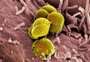 Καμπανάκι ΕΟΔΥ για τα ΣΜN: Τριπλασιάστηκαν τα περιστατικά γονόρροιας, διπλασιάστηκαν οι διαγνώσεις πρώιμης σύφιλης