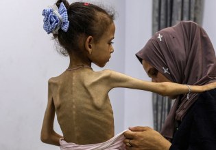 Λιμός στη Γάζα: Αντιμέτωπα με δια βίου επιπτώσεις τα παιδιά