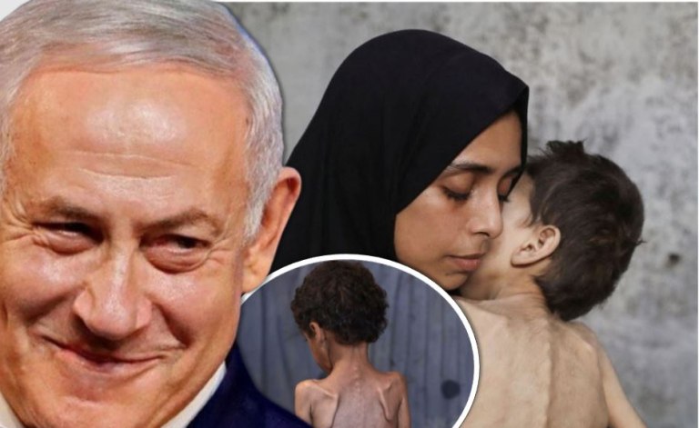 «Σφαγή σε slow motion» – Πώς καταστρέφεται το σώμα εκατοντάδων χιλιάδων Παλαιστινίων