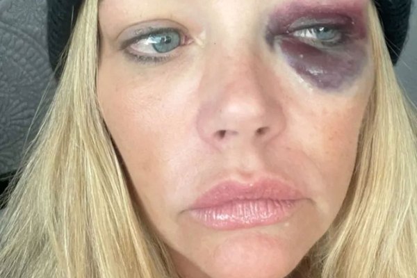 Με κλώτσαγε, μου χτυπούσε το κεφάλι στην κρεμάστρα, ήθελε να με σκοτώσει: Σοκαριστικές καταγγελίες από τη Ντενίζ Ρίτσαρντς για τον πρώην της