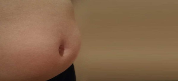 Γενετικό τεστ προβλέπει την παχυσαρκία από την παιδική ηλικία