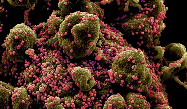 Η Covid και η γρίπη ίσως ξυπνούν κοιμισμένα καρκινικά κύτταρα