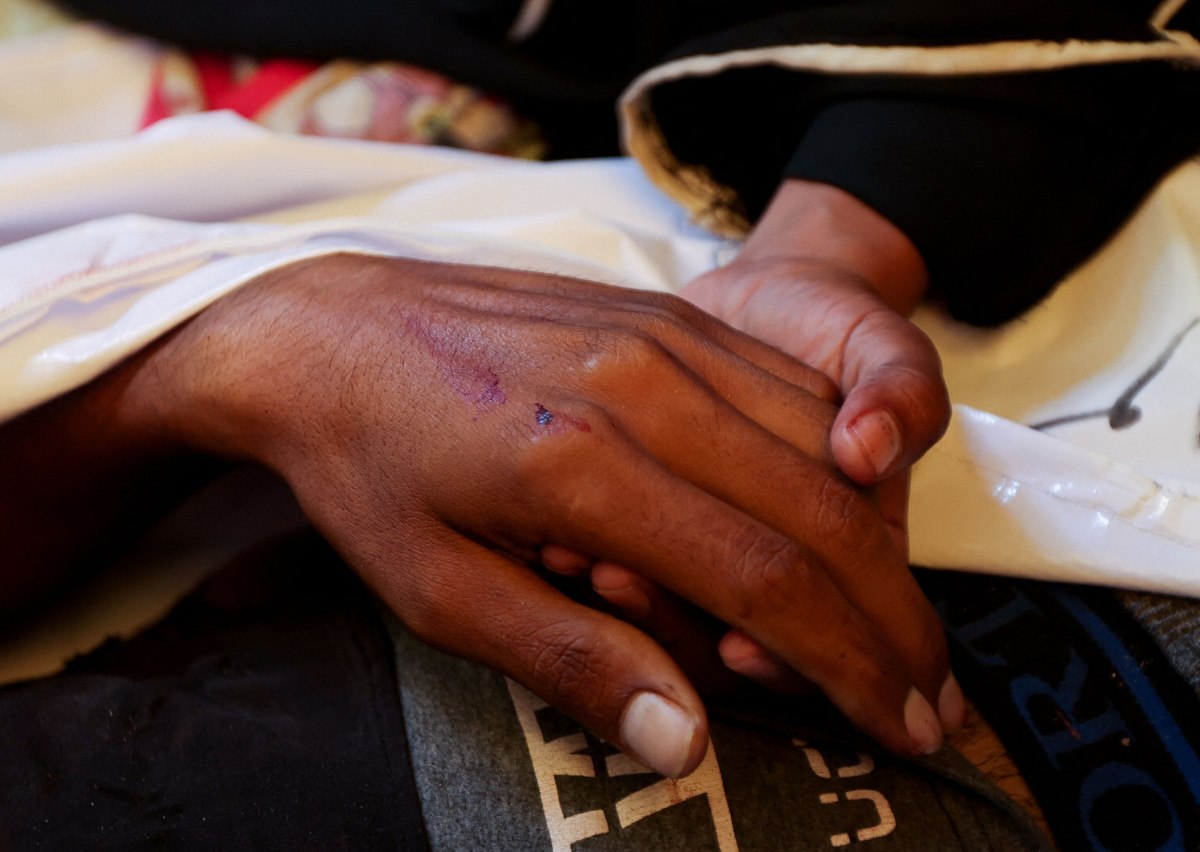 Γάζα: Ο υποσιτισμός βρίσκεται σε επίπεδα που προκαλούν «συναγερμό» λέει ο ΠΟΥ – Νέο αιματοκύλισμα στη Χαν Γιουνίς