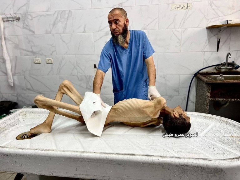 Γάζα: Μόνο το 1,5% της γεωργικής γης είναι πλέον καλλιεργήσιμο – Επιτείνεται ο κίνδυνος «γενικευμένου λιμού»